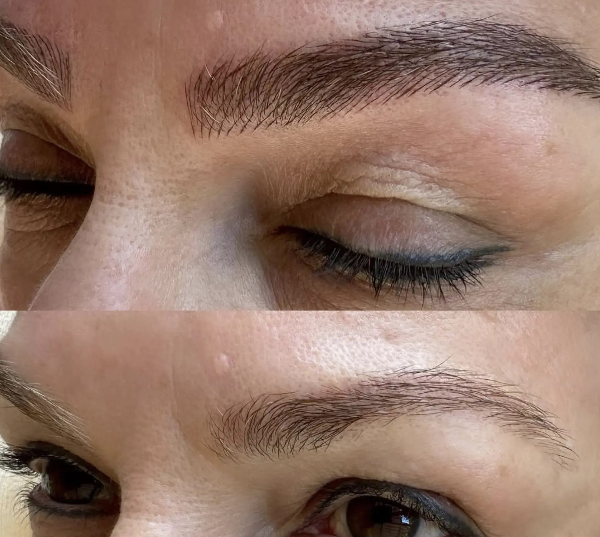 What Happens If You Pick Microblading Scabs?