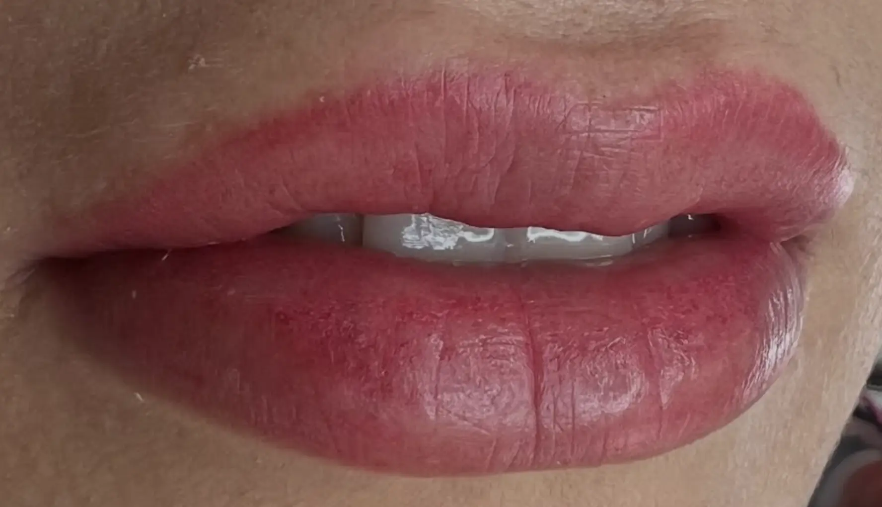 San Sebastian Tour Virtual | What Is Best For Pigmented Lips? lip blush after 2 years