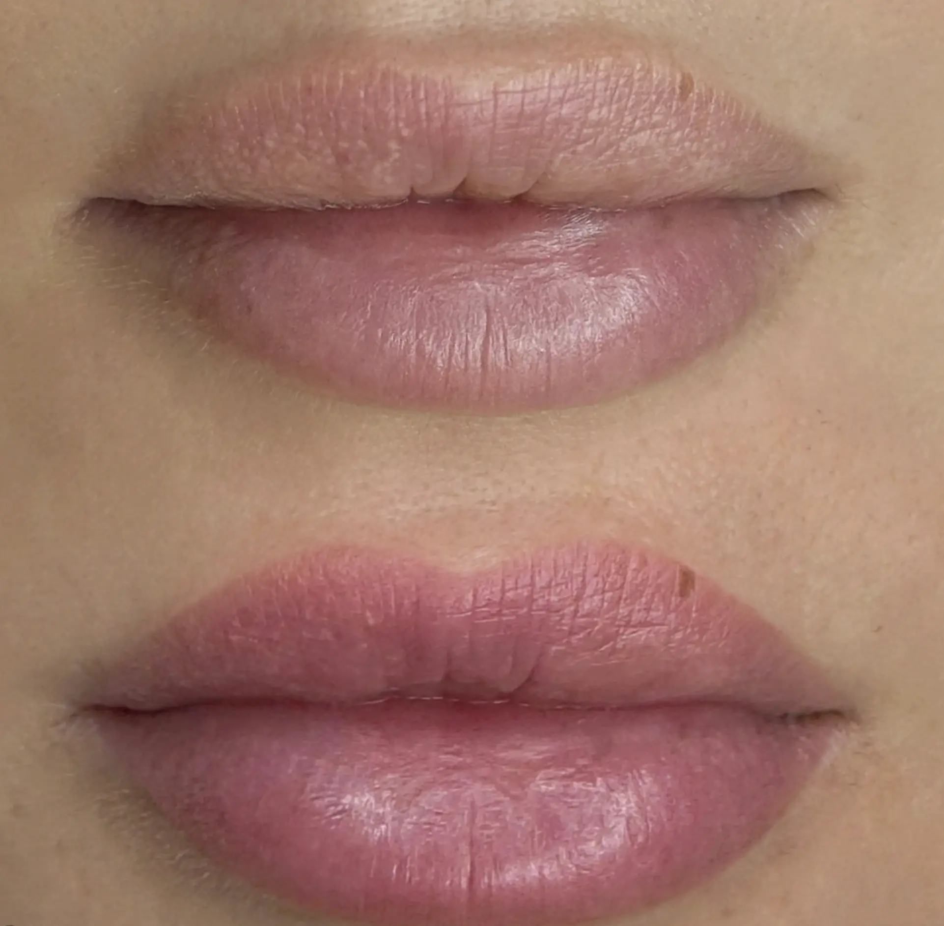 San Sebastian Tour Virtual | What Is Best For Pigmented Lips? lip blush before and after