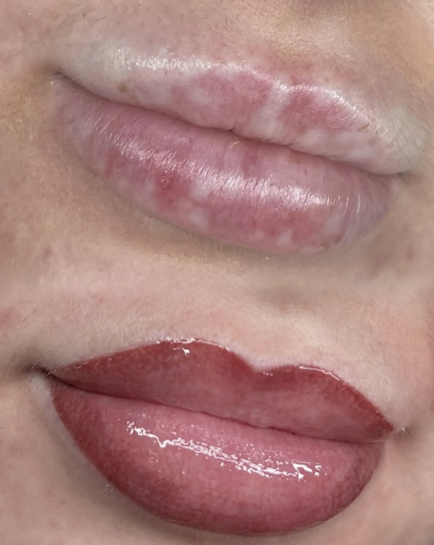 What Is Best For Pigmented Lips?